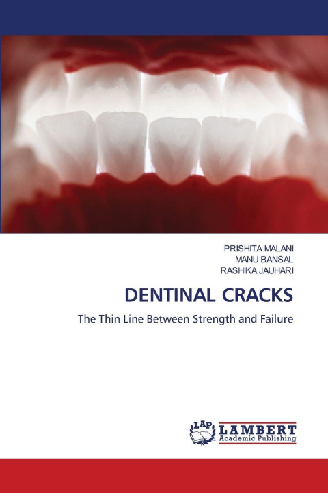 Kniha DENTINAL CRACKS Manu Bansal
