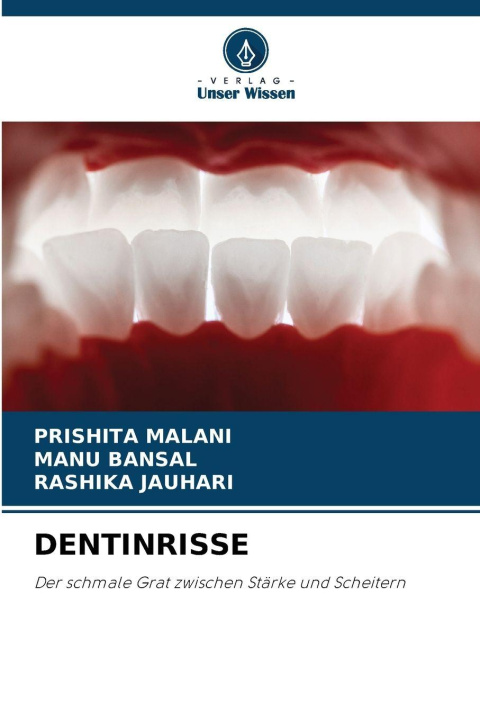 Book DENTINRISSE Manu Bansal