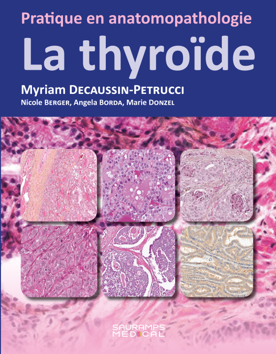 Kniha La thyroIde DECAUSSIN-PETRUCCI