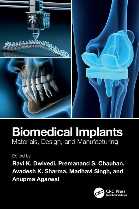 Kniha Biomedical Implants Avadesh K. Sharma