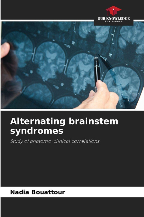 Kniha Alternating brainstem syndromes Nadia Bouattour