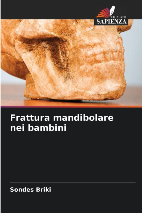 Knjiga Frattura mandibolare nei bambini Sondes Briki