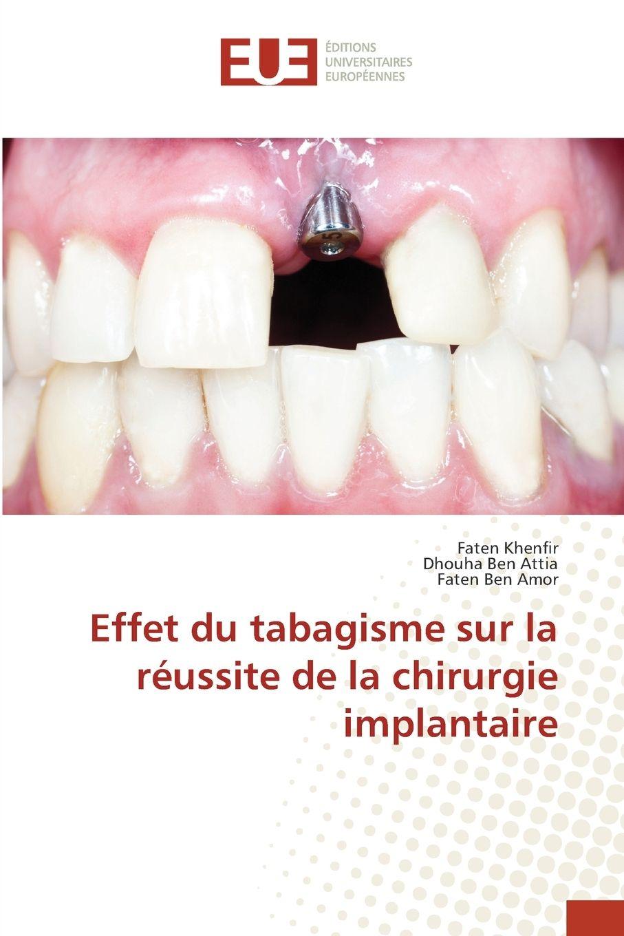 Knjiga Effet du tabagisme sur la réussite de la chirurgie implantaire Faten Khenfir