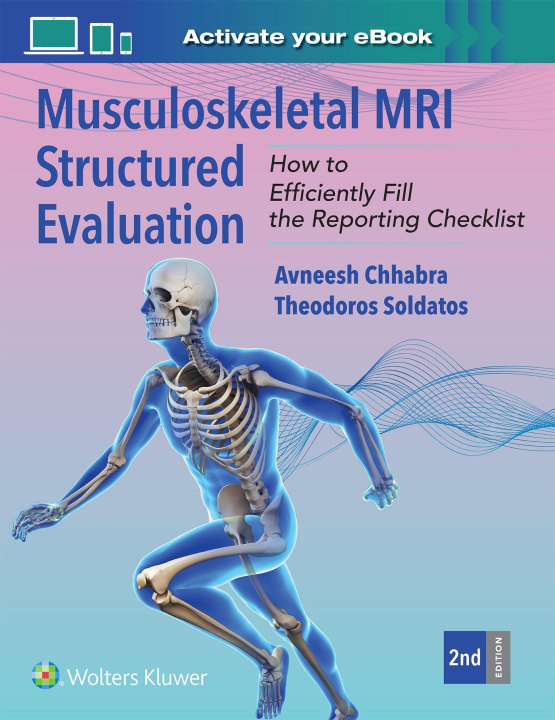 Kniha Musculoskeletal MRI Structured Evaluation Theodoros Soldatos