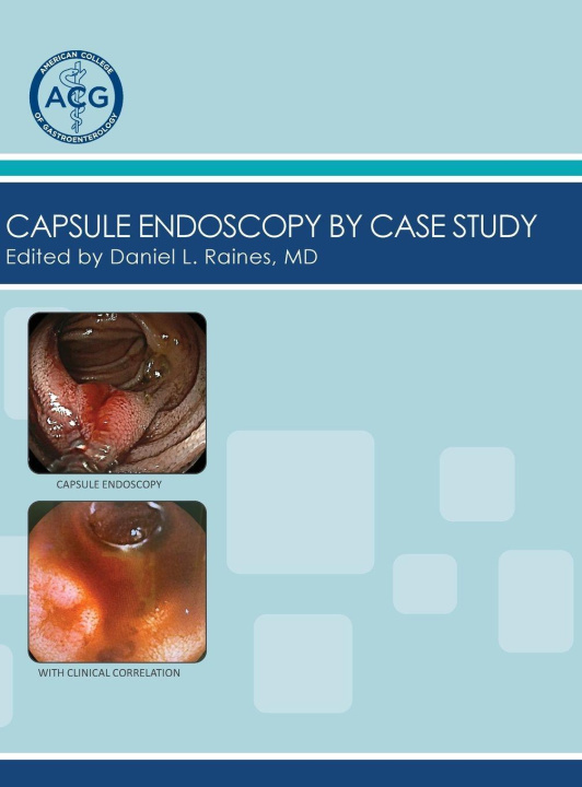 Kniha Capsule Endoscopy by Case Study, Volume 2 Daniel L. Raines