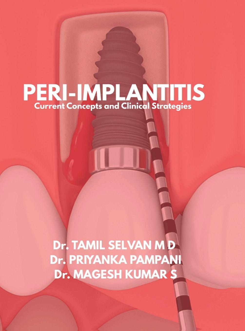 Kniha Peri-Implantitis Dr. Tamil Selvan M D