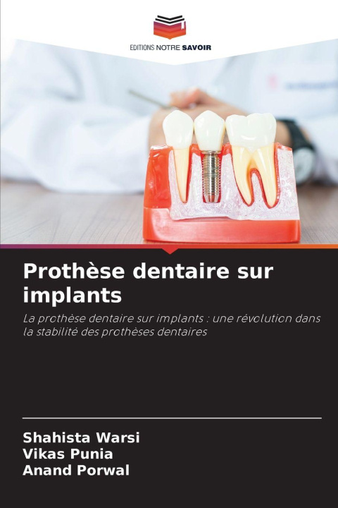 Kniha Prothèse dentaire sur implants Vikas Punia