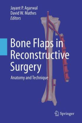 Kniha Bone Flaps in Reconstructive Surgery Jayant P. Agarwal