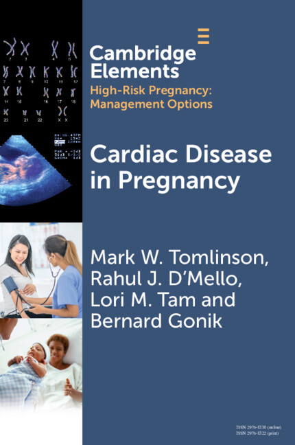 Knjiga Cardiac Disease in Pregnancy Mark W. Tomlinson