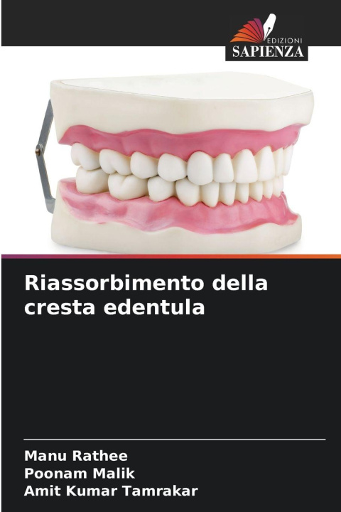Knjiga Riassorbimento della cresta edentula Manu Rathee