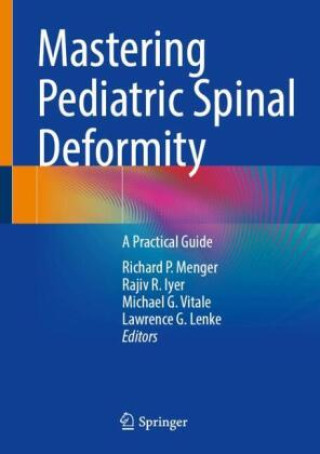 Kniha Mastering Pediatric Spinal Deformity Richard P. Menger