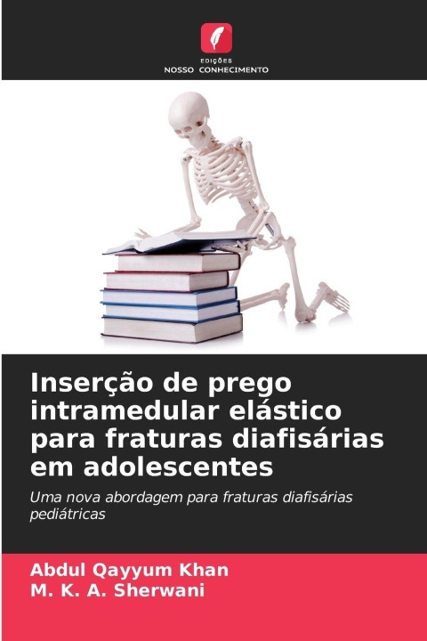 Kniha Inserção de prego intramedular elástico para fraturas diafisárias em adolescentes Abdul Qayyum Khan