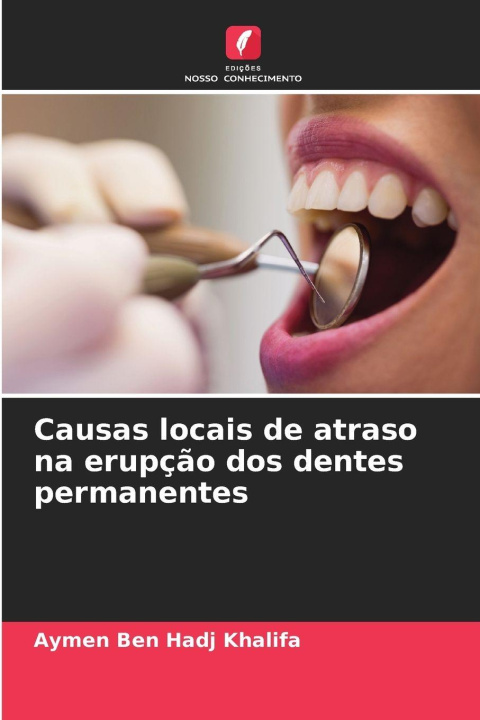Kniha Causas locais de atraso na erupção dos dentes permanentes Aymen Ben Hadj Khalifa