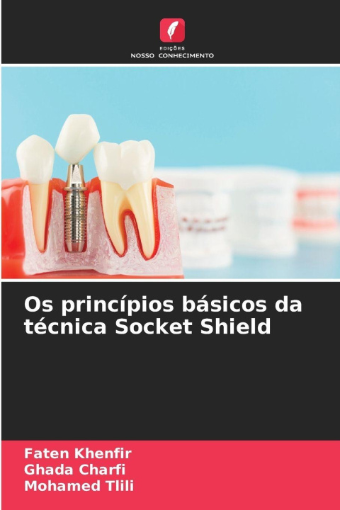 Kniha Os princípios básicos da técnica Socket Shield Faten Khenfir