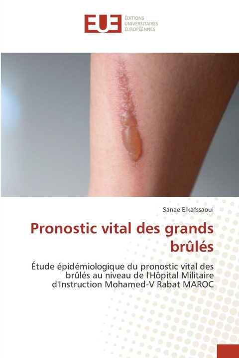 Boek Pronostic vital des grands brûlés Sanae Elkafssaoui