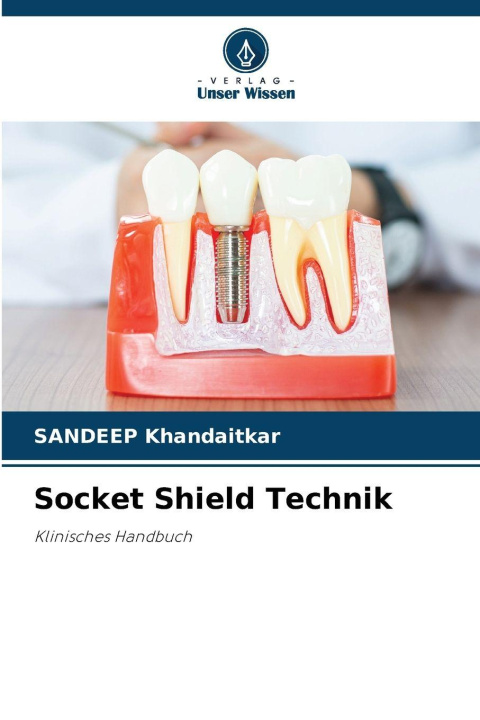 Knjiga Socket Shield Technik SANDEEP KHANDAITKAR