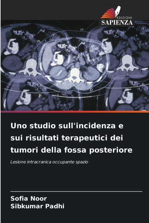 Książka Uno studio sull'incidenza e sui risultati terapeutici dei tumori della fossa posteriore Sibkumar Padhi