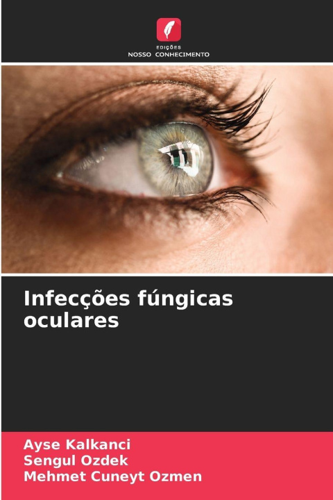 Knjiga Infecções fúngicas oculares Sengul Ozdek