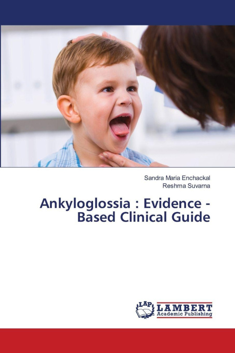 Knjiga Ankyloglossia : Evidence -Based Clinical Guide Sandra Maria Enchackal