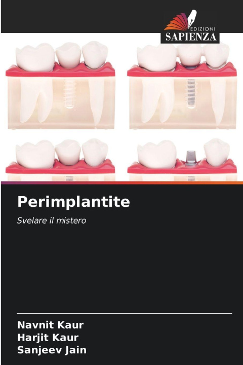 Kniha Perimplantite Navnit Kaur