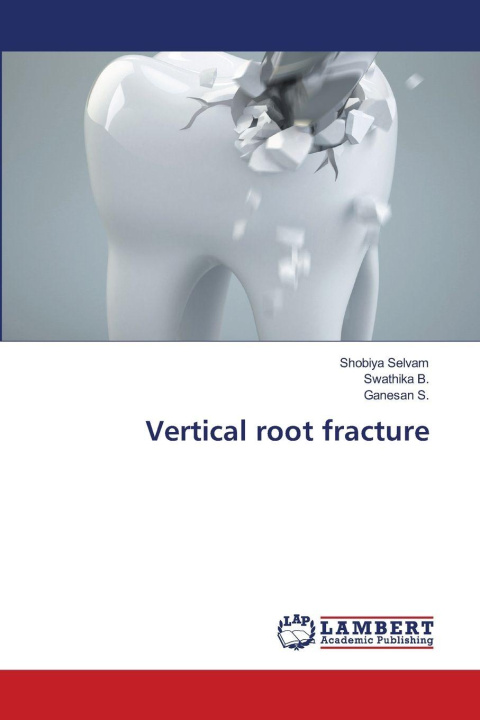 Knjiga Vertical root fracture Shobiya Selvam