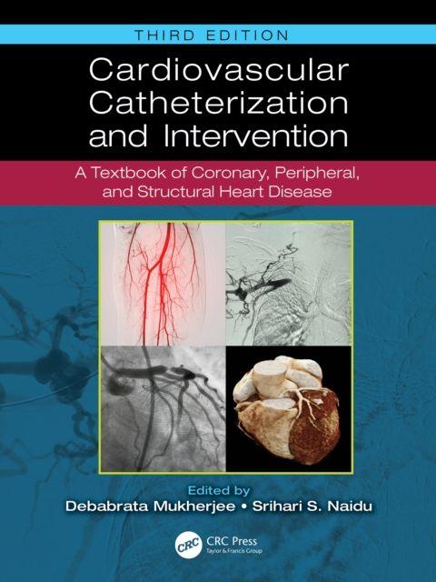 Carte Cardiovascular Catheterization and Intervention Srihari S. Naidu
