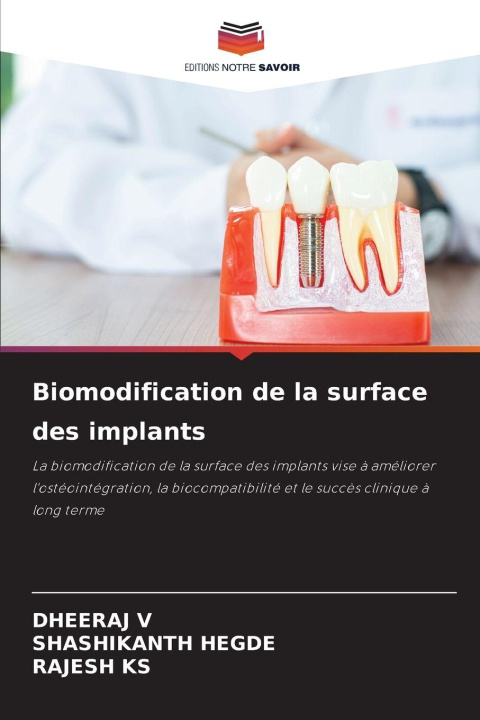 Knjiga Biomodification de la surface des implants Shashikanth Hegde