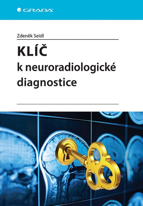 Βιβλίο Klíč k neuroradiologické diagnostice Dostálová I.