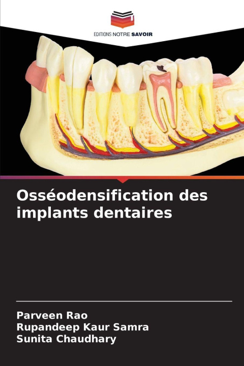 Kniha Osséodensification des implants dentaires Parveen Rao