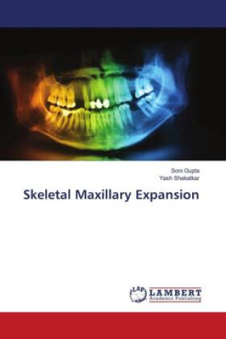 Knjiga Skeletal Maxillary Expansion Soni Gupta