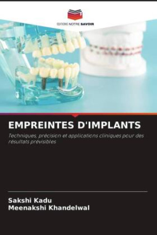 Kniha EMPREINTES D'IMPLANTS Meenakshi Khandelwal