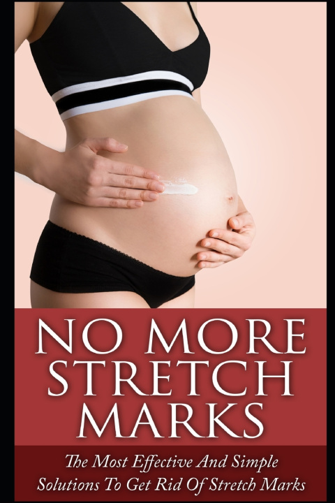 Knjiga No More Stretch Marks Elizabeth Grace