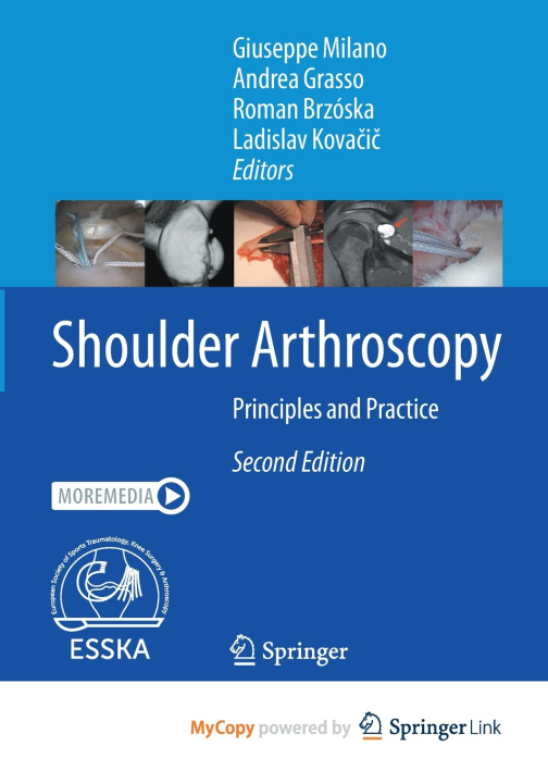 Книга Shoulder Arthroscopy Giuseppe Milano