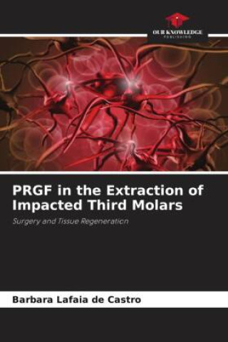 Kniha PRGF in the Extraction of Impacted Third Molars Barbara Lafaia de Castro