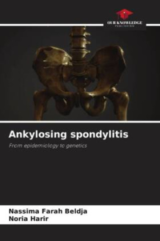 Knjiga Ankylosing spondylitis Nassima Farah Beldja