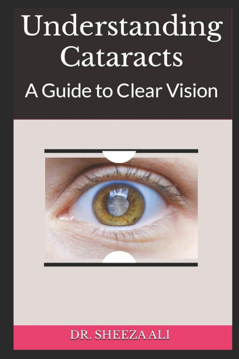 Kniha Understanding Cataracts Dr. Sheeza Ali