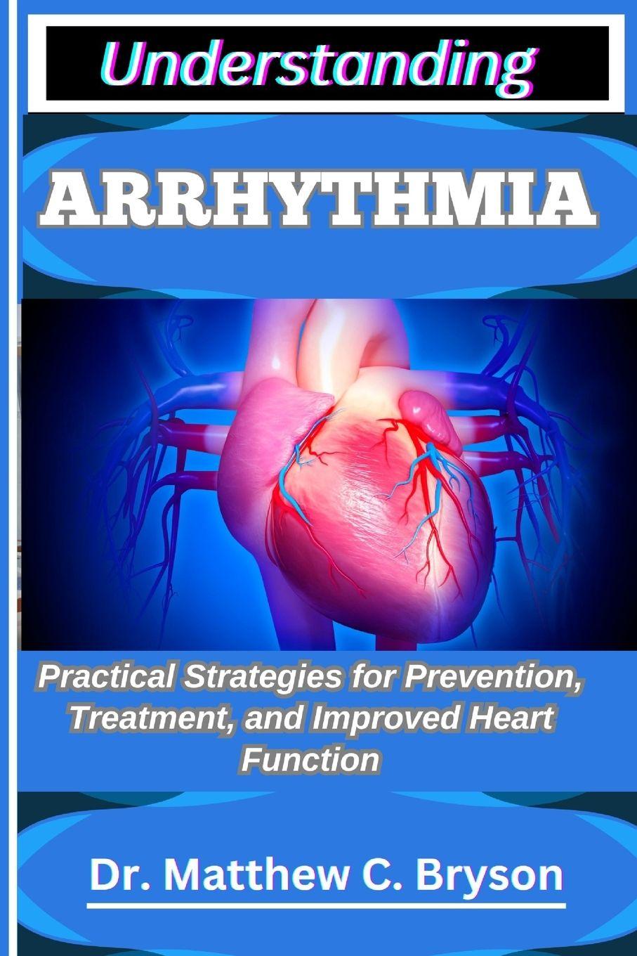 Kniha UNDERSTANDING ARRHYTHMIA Dr. Matthew C. Bryson