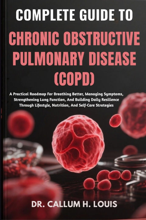 Knjiga COMPLETE GUIDE TO CHRONIC OBSTRUCTIVE PULMONARY DISEASE (COPD) DR. CALLUM H. LOUIS
