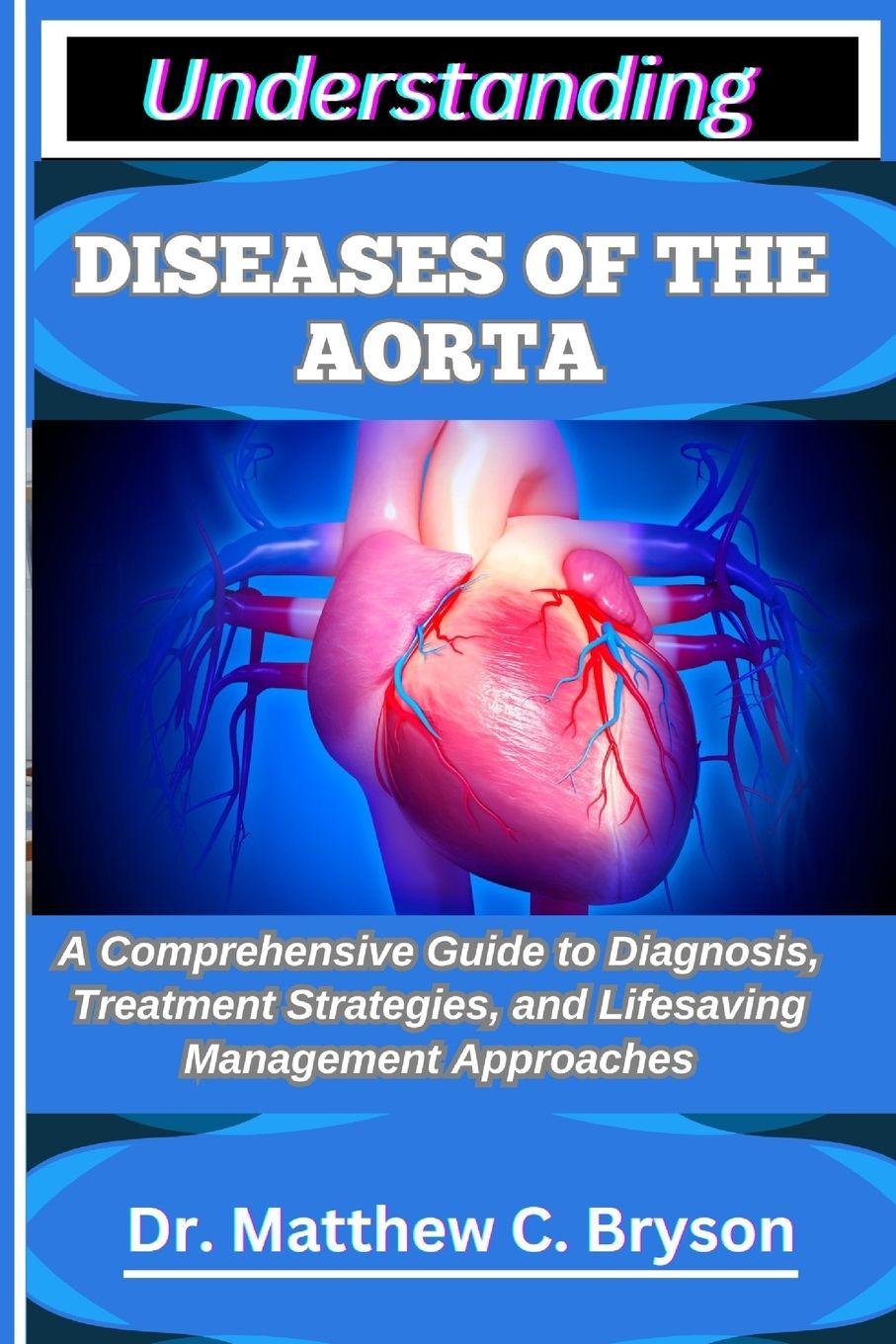 Knjiga UNDERSTANDING DISEASES OF THE AORTA Dr. Matthew C. Bryson
