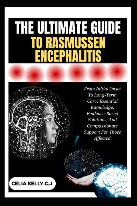 Книга THE ULTIMATE GUIDE TO RASMUSSEN ENCEPHALITIS CELIA KELLY.C.J