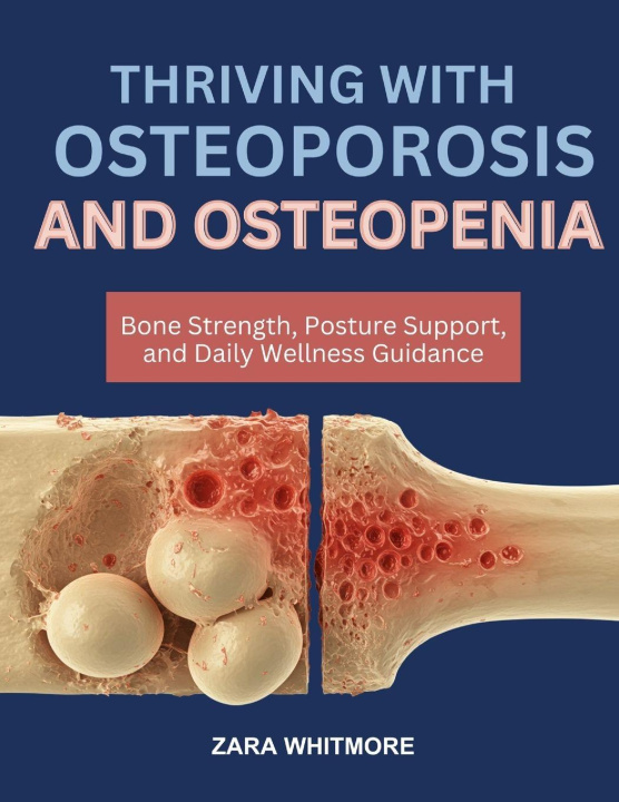 Kniha THRIVING WITH OSTEOPOROSIS AND OSTEOPENIA ZARA WHITMORE