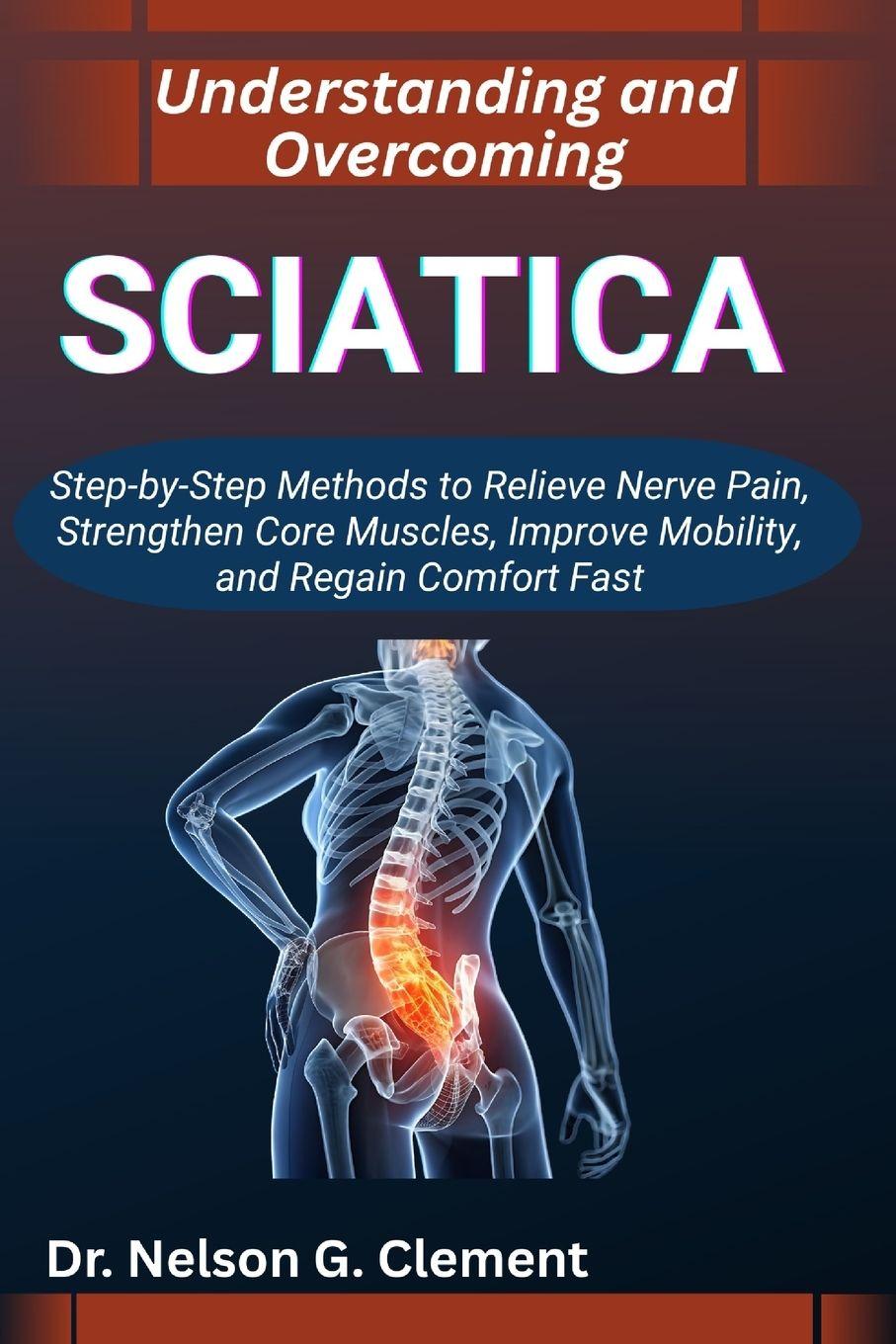 Kniha UNDERSTANDING AND OVERCOMING SCIATICA Dr. Nelson G. Clement
