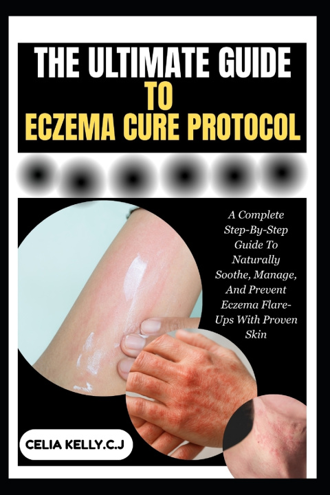 Книга THE ULTIMATE GUIDE TO ECZEMA CURE PROTOCOL CELIA KELLY.C.J