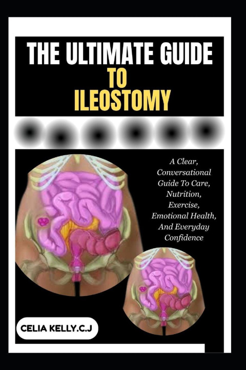 Книга THE ULTIMATE GUIDE TO ILEOSTOMY CELIA KELLY.C.J