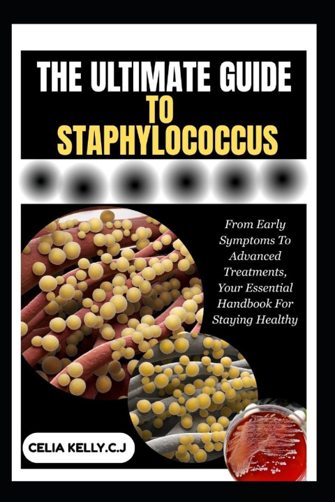 Knjiga THE ULTIMATE GUIDE TO STAPHYLOCOCCUS CELIA KELLY.C.J