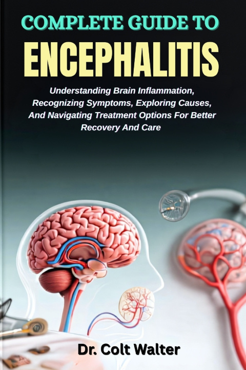 Kniha COMPLETE GUIDE TO ENCEPHALITIS Dr. Colt Walter
