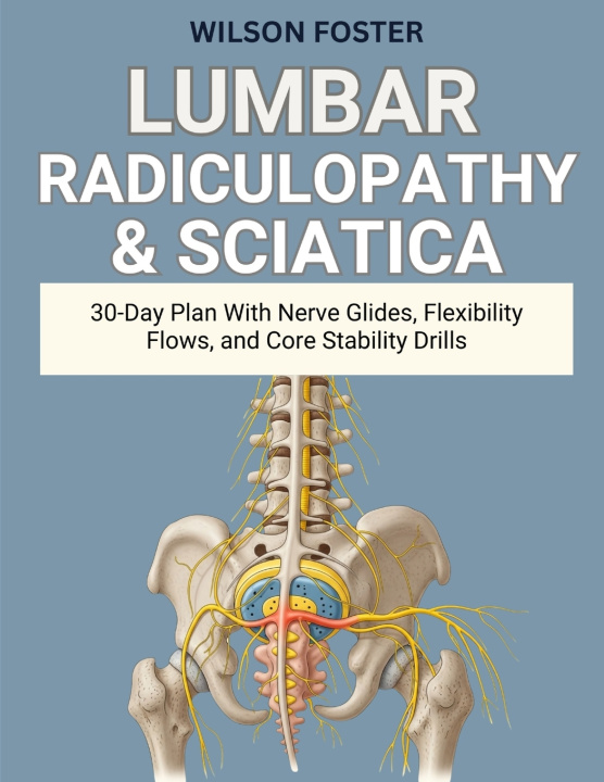 Kniha Lumbar Radiculopathy & Sciatica WILSON FOSTER
