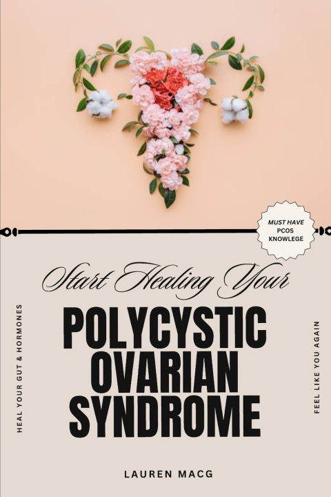Knjiga Start Healing Your Polycystic Ovarian Syndrome Lauren MacGillivray