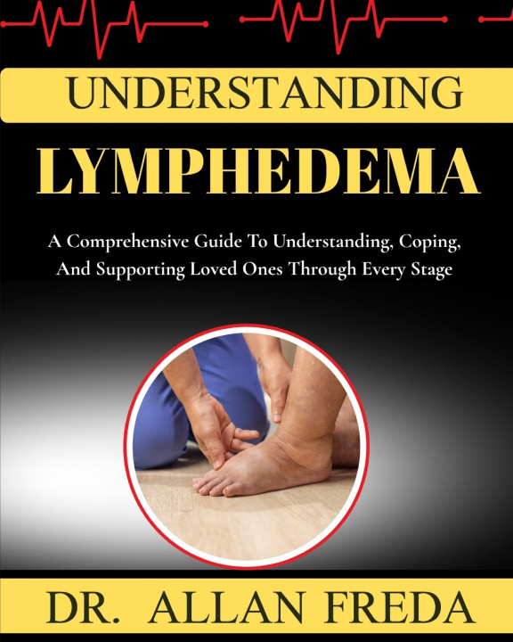 Könyv Understanding lymphedema DR. ALLAN FREDA