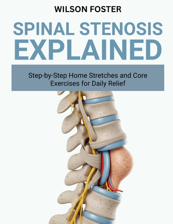 Kniha Spinal Stenosis Explained WILSON FOSTER